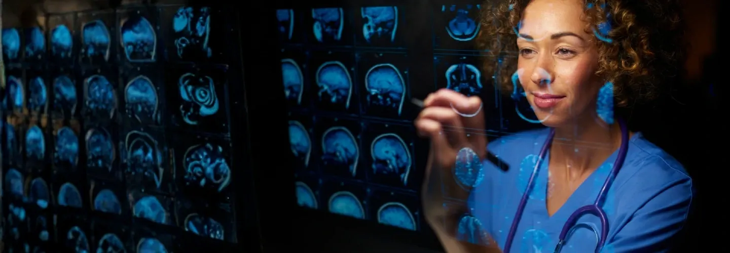MedTech AI brain imaging